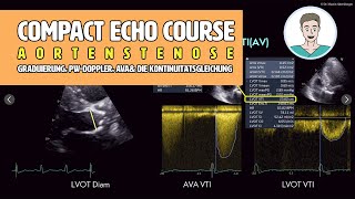 〖Echokardiografie〗 Quantifizierung der Aortenklappenstenose - "all the numbers"🫀