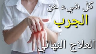 الأقوى الوصفات للجرب _ الأعراض والوقاية والعلاج النهائي #كن_عالما_بارعا #طب_الاعشاب