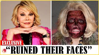 25 Hollywood Celebrities Who RUINED Their Careers With PLASTIC | Who died today 2024