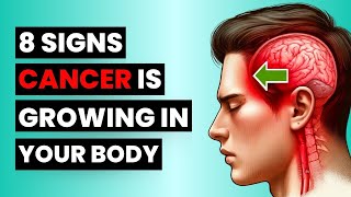 If YOU HAVE 2 OR MORE OF THIS SIGNS, VISIT YOUR DOCTOR AS SOON AS POSSIBLE, #cancer