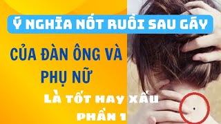 Ý nghĩa nốt ruồi sau gáy của đàn ông và phụ là nữ tốt hay xấu phần 1?