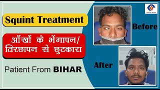 Squint Surgery | भेंगेपन का इलाज | Strabismus Treatment |Patient Review