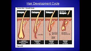 9:50  Alopecia  Etiopathogenesis  and classification  Clinical forms  Algorithm of diagnostics