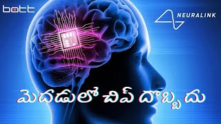 మెదడులో చిప్‌ దొబ్బదు | Neuralink brain chip | BOTT News #hyderabad