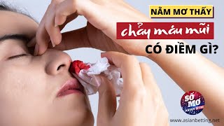 Nằm mơ thấy chảy máu mũi có điềm gì? | Asianbetting.net