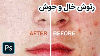 چطور لکه، خال و جوش را در فتوشاپ از پوست حذف کنیم؟ - How to Remove Acne pimple in Photoshop