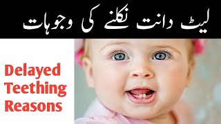 Understanding Late Teething in Babies | Baby teething problems and Solutions