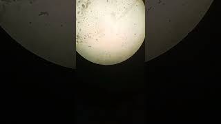 Microscopic View of Urine Sample