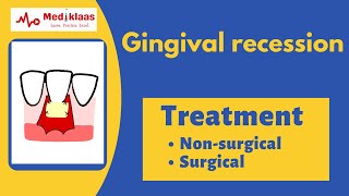 Gingival Recession - Treatment (Non-surgical, surgical) l Perio plastic surgery l Mediklaas