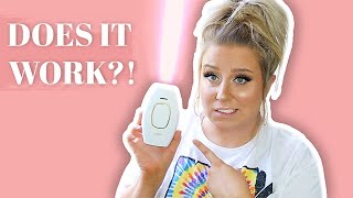 I Tried Laser Hair Removal AT HOME!! Did it work?