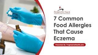 7 Food Allergies That Cause Eczema