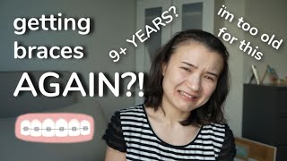 Why my teeth need braces again | my sad orthodontic journey &  getting braces as an adult