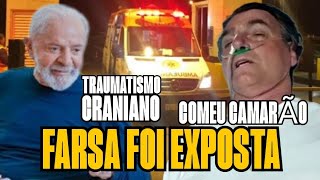 🔥🔥🔥 LULA EM GRAVE AClDENTE!! FARSA H0SPlTALAR DE B0LS0NAR0 F0l EXP0STA!! TUD0 C0NTAD0 PELA MÉDlC0!!