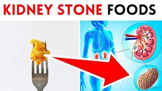 7 Foods That Turn Into Kidney Stones! Stop Eating These Kidney Stone Causing Foods!