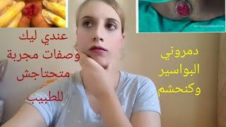 تلات وصفات مجربة في علاج البواسير /والله كلها شافية/عالجي قبل متبلجي