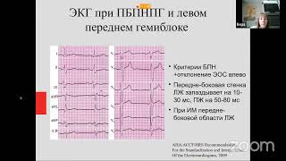 Особенности сердечной ресинхронизирующей терапии. Показания, критерии диагностики