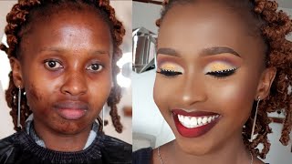 POWER OF MAKEUP TRANSFORMATION ON ACNE PRONE SKIN.