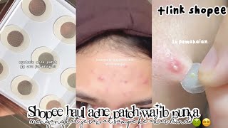 SHOPEE HAUL ACNE PATCH PEMBASMI JERAWAT SAMPE KE AKAR WAJIB PUNYA ACNE FIGHTER RACUN TIKTOK