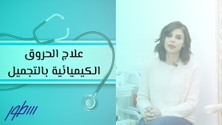 علاج الحروق الكيميائية بالتجميل