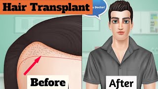 Hair Transplant treatment 3d animation video