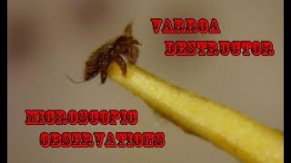 Varroa Destructor Microscopic Observations!