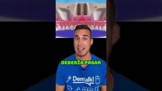 Va al DENTISTA y termina con un IMPLANTE DENTAL en el CEREBRO 🧠 - ¿Cómo es posible?