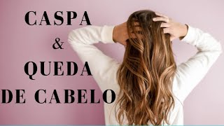 CASPA causa QUEDA CABELO? Por Luiz Gameiro, dermatologista