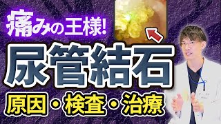 尿管結石、尿路結石の原因・検査・治療について泌尿器科専門医が詳しく解説