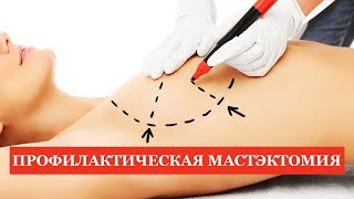 Профилактическая мастэктомия. Фиброаденомы. Внутрипротоковые папилломы.