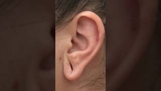 DO YOU HAVE GAUGED EARLOBES?