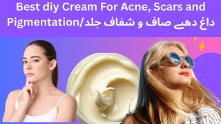 Best diy  cream for acne,scars and pigmentation/make crystal clear skin/#skincare