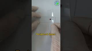 Making a peripheral blood smear | blood smear preparation | prepare a perfect blood smear|Hematology