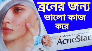 Acne Star Cream | AcneStar Gel | ব্রনের জন্য ভালো কাজ করে | Putul Cosmetics Dhaka |