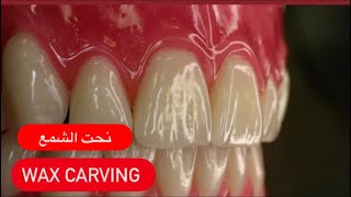 Wax carving ASMR in HD #WAXBAE #DENTURES