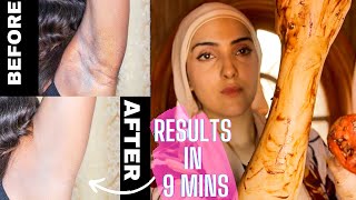 HOW TO LIGHTEN DARK/UNEVEN ARMPITS, KNUCKLES + TOES FAST ~ Immy