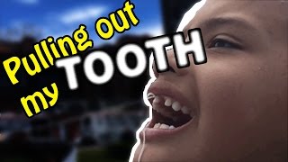 Pulling out my Tooth to avoid Public Speaking[Story]