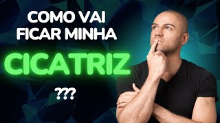 Como vai ficar minha cicatriz? Por Luiz Gameiro, dermatologista