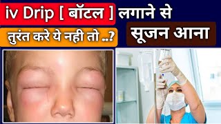 iv drip लगाने से मरीज की आंखे और मुंह में सूजन | iv drip | iv drip kaise lagaye | Medical jankari