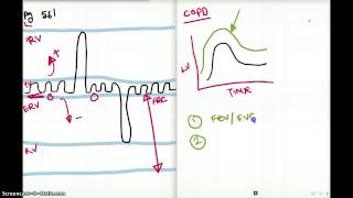 561 FA 2012 : LUNG VOLUMES AND SOME CLINICAL SCENERIOS