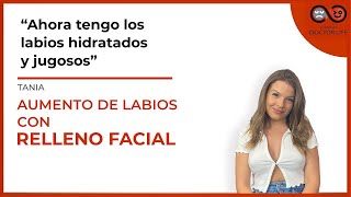 AUMENTO DE LABIOS CON RELLENO FACIAL - CLÍNICAS DOCTOR LIFE