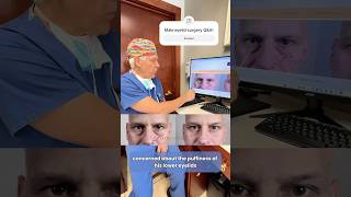 New Jersey top plastic surgeon Dr. Parker explains male eyelid surgery!#maleplasticsurgery