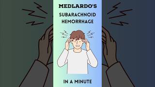 Subarachnoid hemorrhage in a minute #medicine #doctor #medicalstudent  #nurse #medical #medic