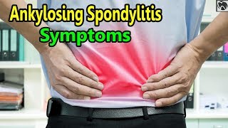 Ankylosing Spondylitis Symptoms | 6 Early Symptoms of Ankylosing Spondylitis