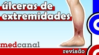 Úlceras de Extremidades | ARTIGO