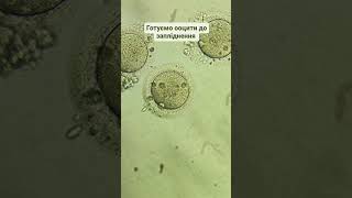 We prepare human oocytes for fertilization. Готуємо яйцеклітини до запліднення. #embrio #icsi #ivf