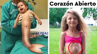 8 Niños reales que son milagros médicos andantes