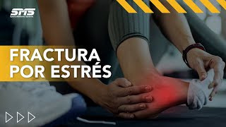 Fracturas por estrés | Sports Medicine Systems