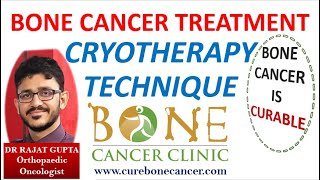 Bone Cancer Treatment Limb Salvage Surgery for Osteosarcoma Cryotherapy (Liquid Nitrogen) Technique