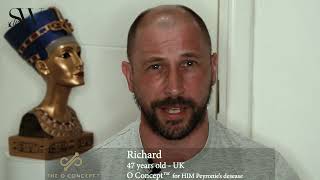 Richard, 47, Peyronie's Disease Testimonial | Dr Sherif Wakil