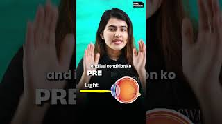 Cataract and Presbyopia Explained in 40 Seconds #shorts #class10th #class10thscience